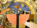 TomoTherapy:TomoTherapy: A better way